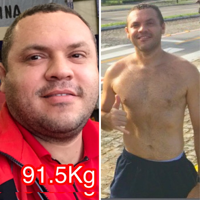 Kimberly — antes e depois
